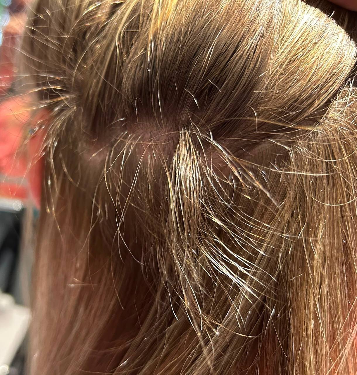 Haarkonzept – nachgewachsenes Haar an der Kopfhaut